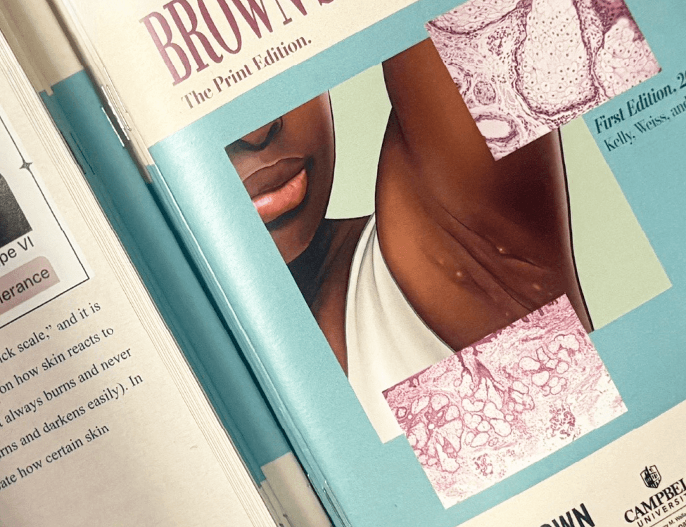 The physical cover of the Brown Skin Matters booklet with an illustration of Hidradenitis Suppurativa on the cover drawn by Evyn Caiazza.