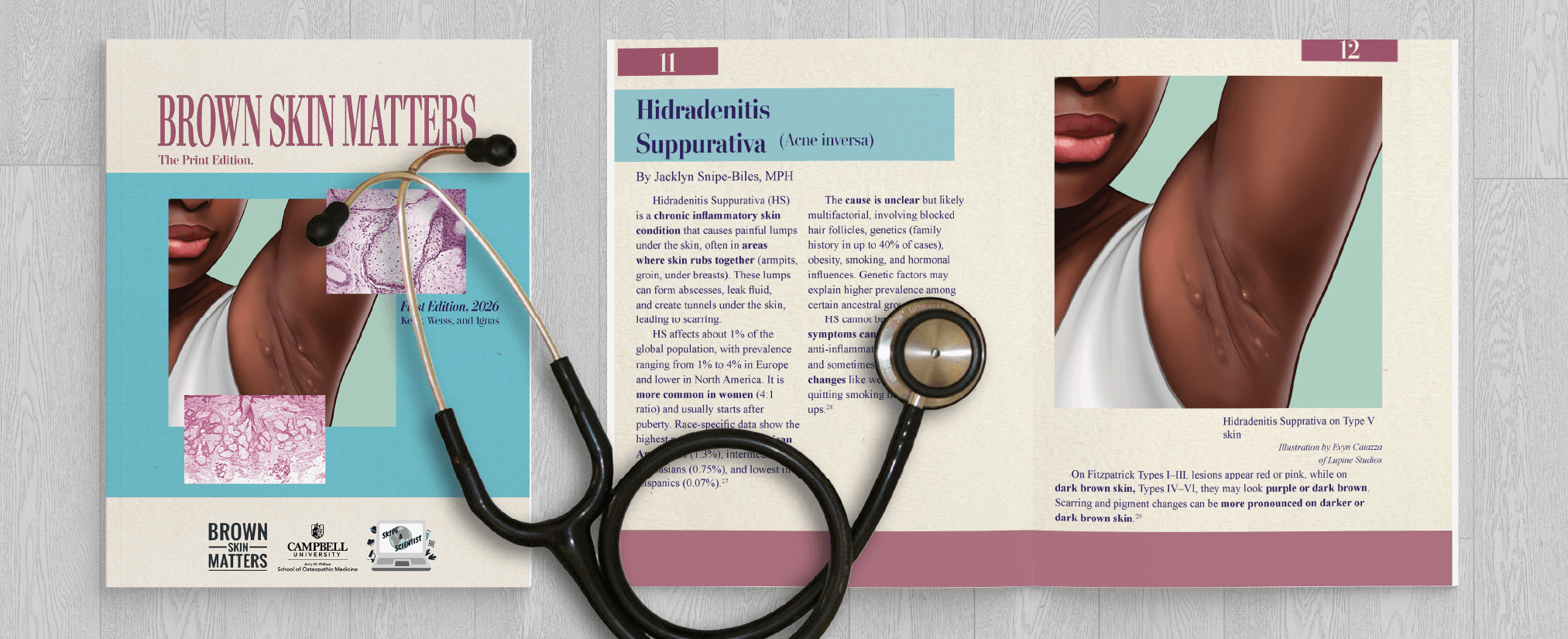 The cover and inner spread of the Brown Skin Matters booklet, revealing an illustration of a black woman raising her armpit to reveal Hidradenitis Suppurativa. The illustration is drawn by Evyn Caiazza.